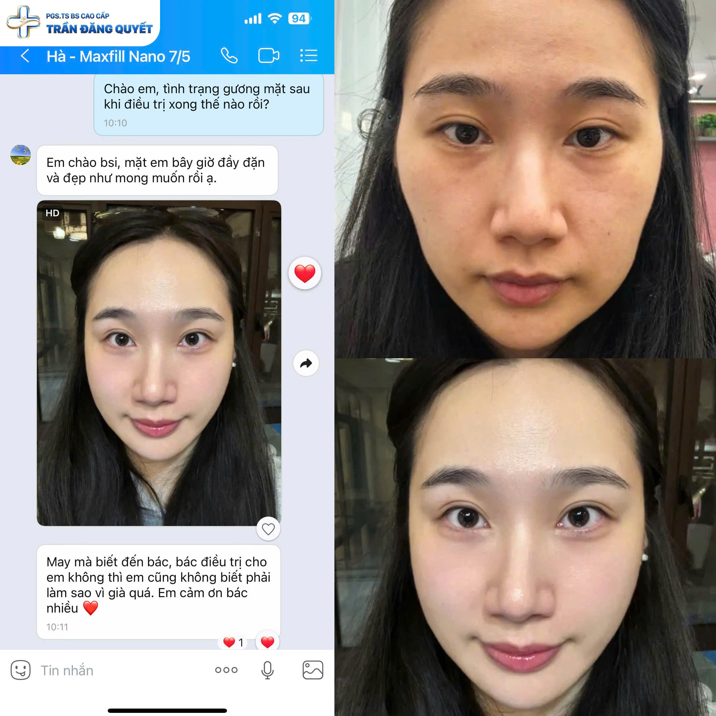 anh-4-1759984671.jpg