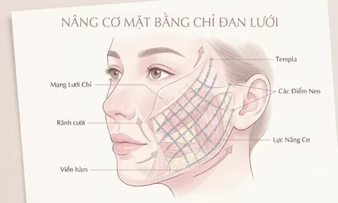 Bio Meshwork - Bước tiến mới trong kỹ thuật cân chỉnh lõm hóp và tái cấu trúc gương mặt toàn diện