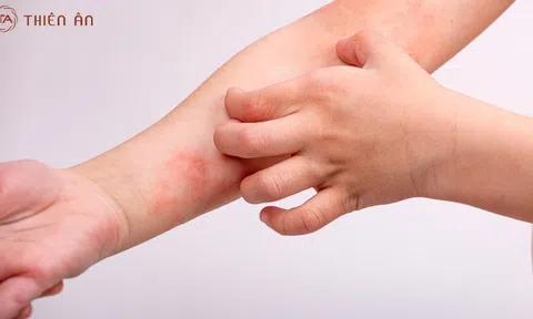 Bỏ túi bí quyết phục làm dịu và hồi da trong mùa hanh khô