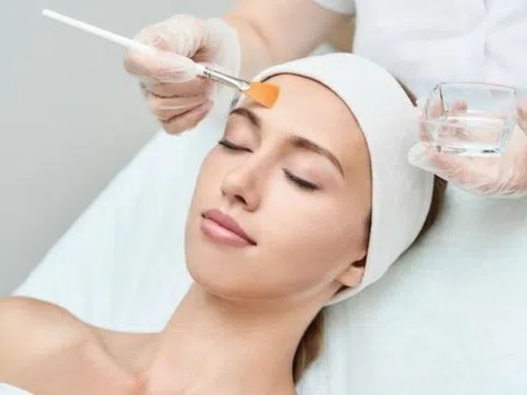 Peel da là gì? Giải mã phương pháp làm đẹp hot nhất hiện nay