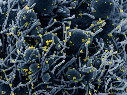 Covid-19 dễ lây nhất trong vòng 1-2 ngày trước khi xuất hiện triệu chứng