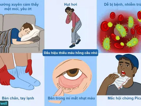 Hội chứng thiếu máu và cách nhận biết