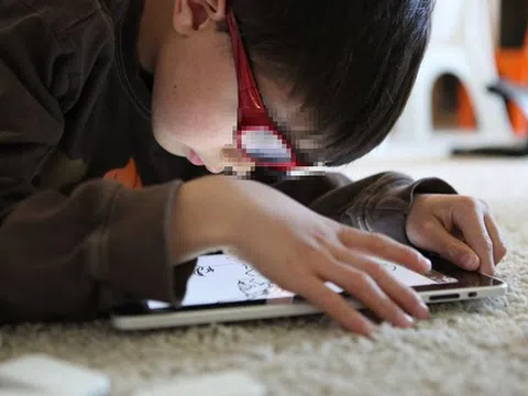 Cách giảm nhức mỏi mắt do sử dụng máy tính