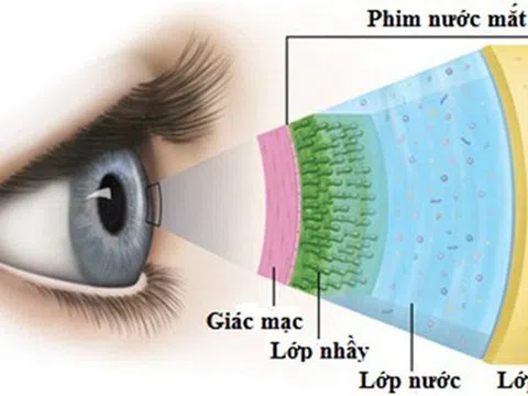Khô mắt và cách khắc phục