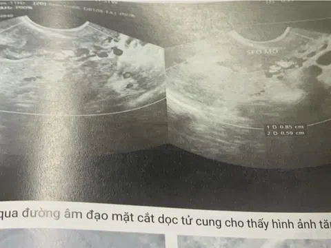 CHU KỲ KINH BẤT THƯỜNG – NỖI LO KHÔNG CỦA RIÊNG AI