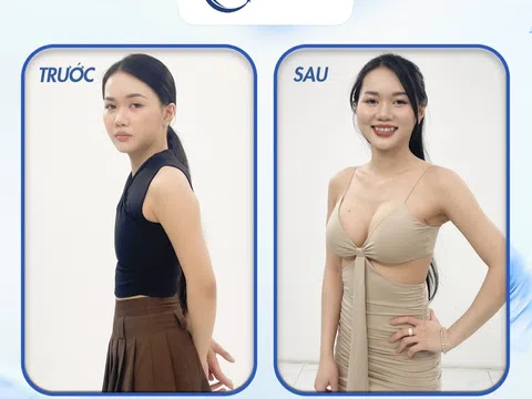 Nâng ngực tại Thẩm Mỹ Viện Seeami Luxury có uy tín và hiệu quả như quảng cáo không?
