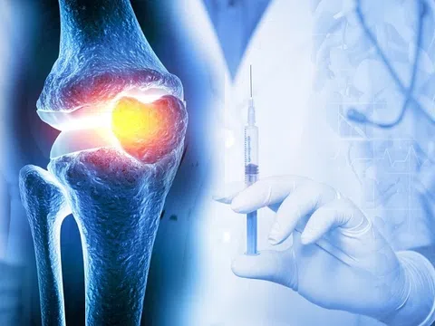 Ứng dụng tế bào gốc trong điều trị thoái hóa khớp gối