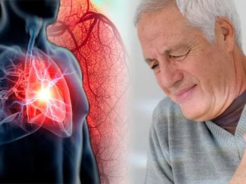 Bệnh tim mạch có ăn Yến Sào được không? Cách ăn yến sào đúng