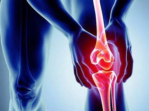 Thoái hoá khớp có ăn Yến Sào được không? Chế độ dinh dưỡng có gì ĐẶC BIỆT?