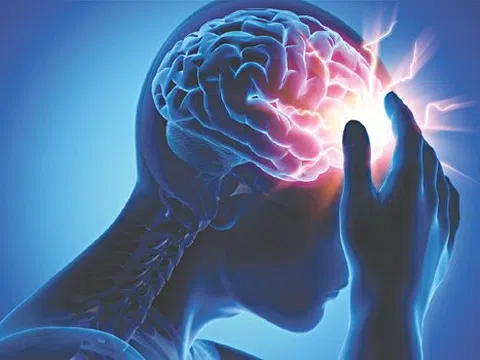Đột quỵ có nên ăn yến sào không? Những lưu ý khi ăn yến sào cho người bị đột quỵ